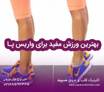 بهترین ورزش مفید برای واریس پا