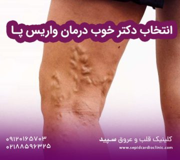 انتخاب دکتر خوب درمان واریس پا
