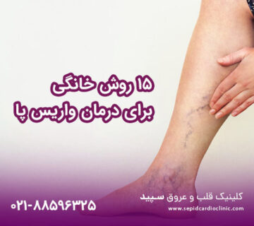 ۱۵ روش خانگی برای درمان واریس پا